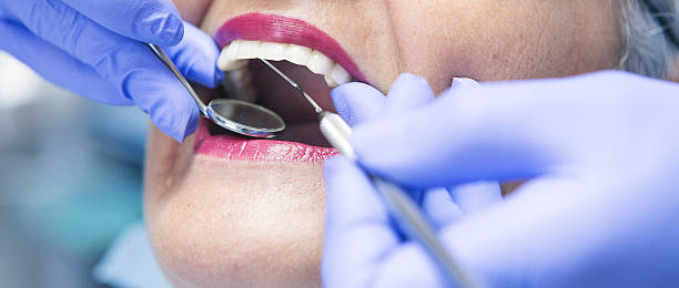Best Emergency Dental Care for Abscessed Tooth in Mariposa, CA
